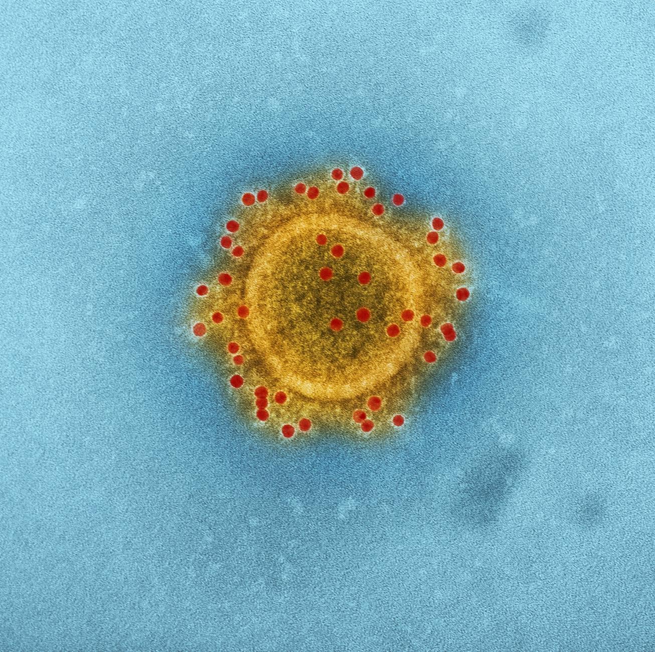 Virus microscopique
