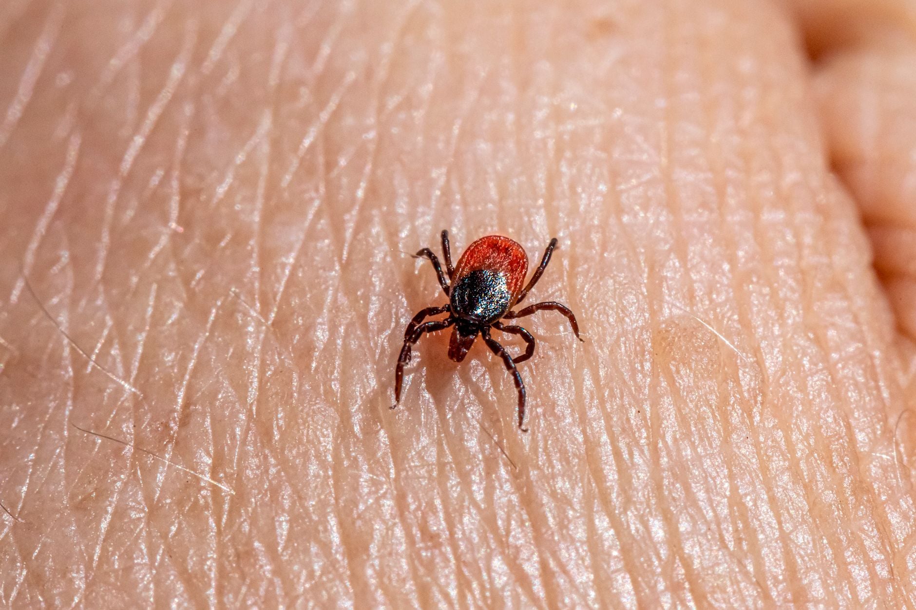 Chigger sur peau humaine